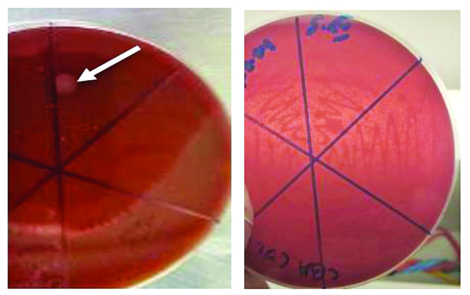 ဆောင်းပါး