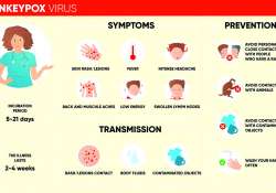 Mpox (မျောက်ကျောက်) ရောဂါအကြောင်း သိကောင်းစရာ သို့မဟုတ် အသိသတိနှင့် ကာကွယ်ရမည့် Mpox (မျောက်ကျောက်) ရောဂါ