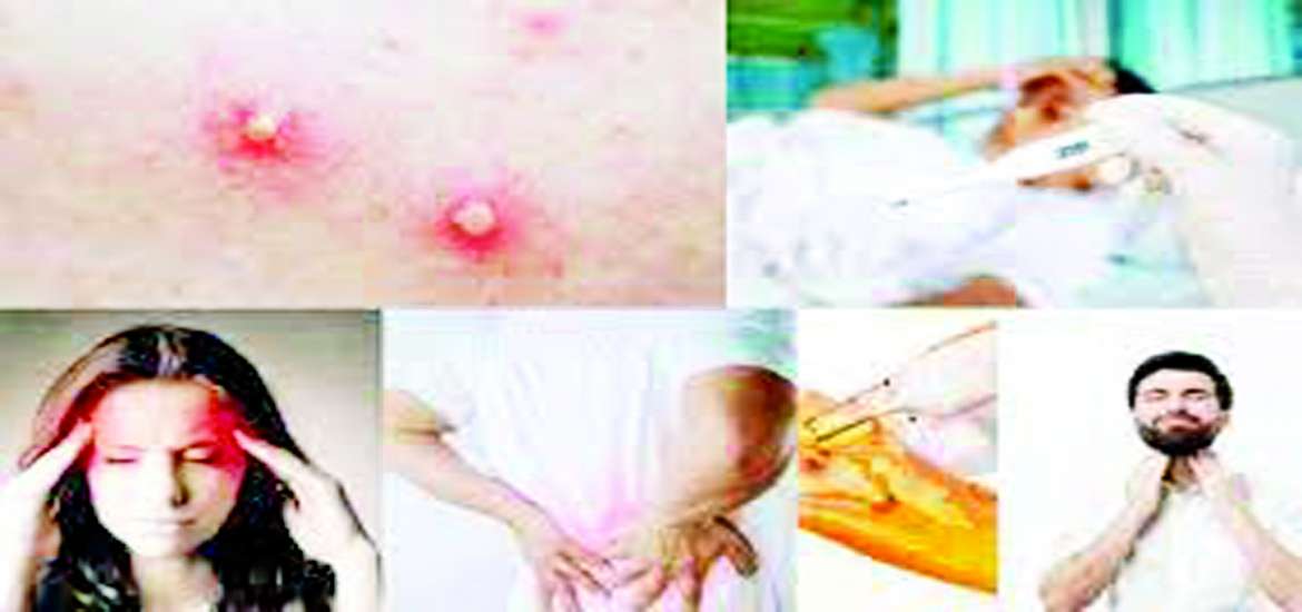 ဆောင်းပါး