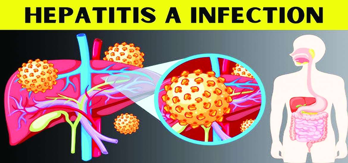 ဆောင်းပါး